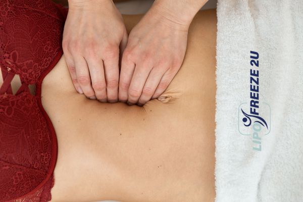 diastasis recti treatment Barking