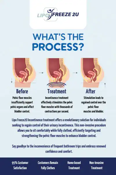 Diagram of how incontinence treatment Barking works.