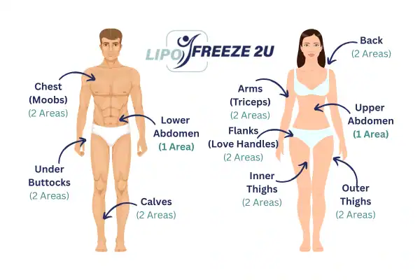 Areas you can have fat freezing treatment Barking
