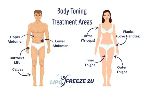 Graphic showing where you can have Body toning Treatment Barking on your body