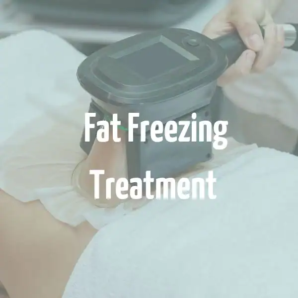 fat freezing treatment Barking