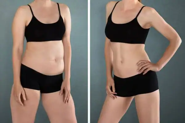 Are There Any Side Effects or Risks to Consider Barking?