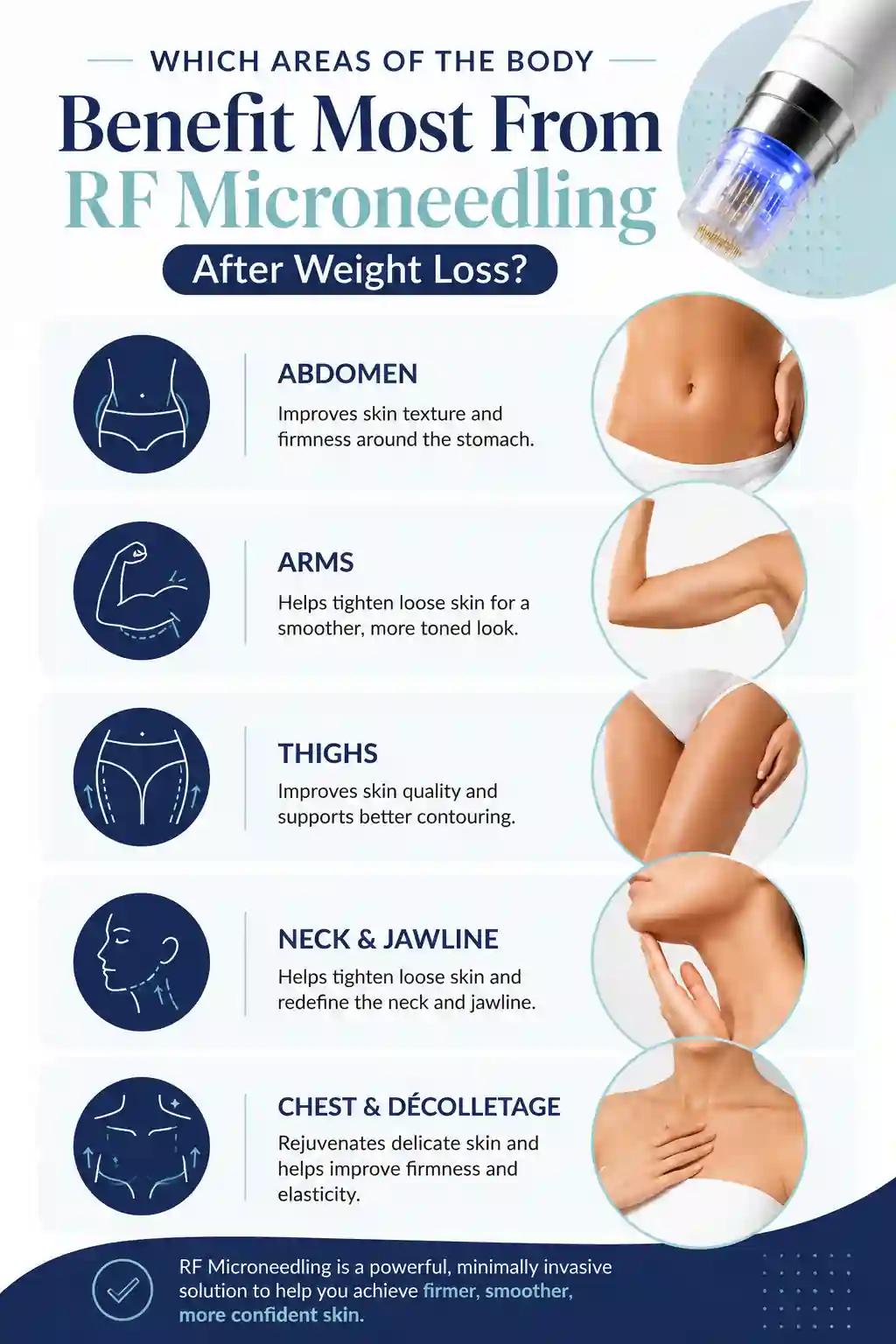 Which Areas of the Body Benefit Most From RF Microneedling After Weight Loss Barking
